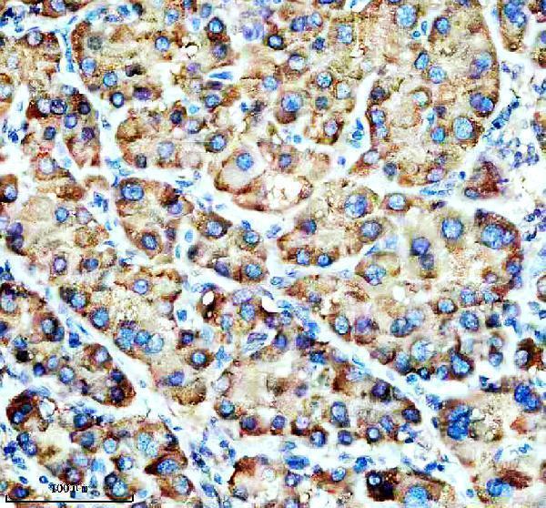 IHC analysis of FADS1 using anti-FADS1 antibody (M02535)
