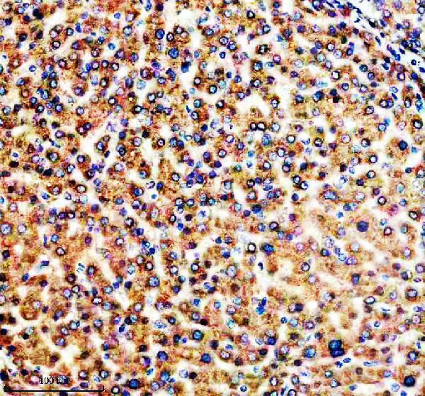 IHC analysis of FADS1 using anti-FADS1 antibody (M02535)