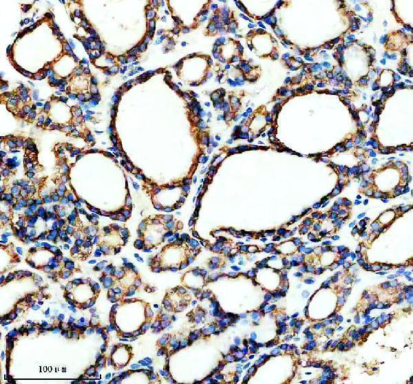 m02535 fads1 primary antibodies ihc testing 3