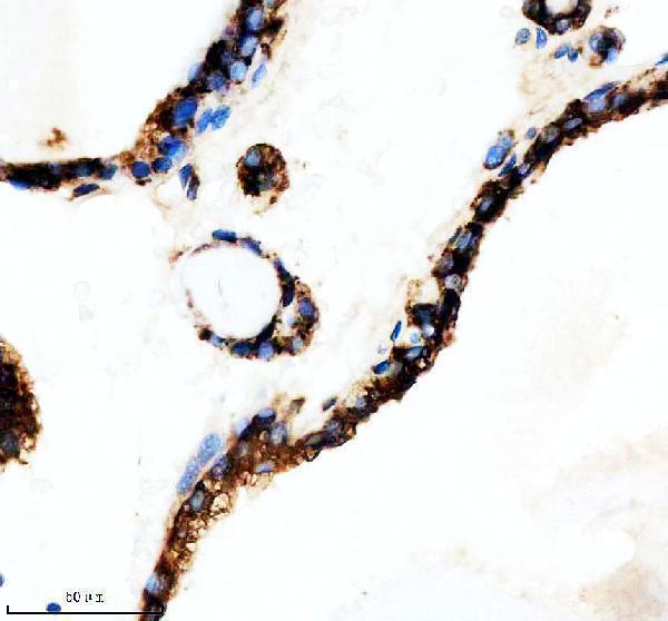 m02535 fads1 primary antibodies ihc testing 4
