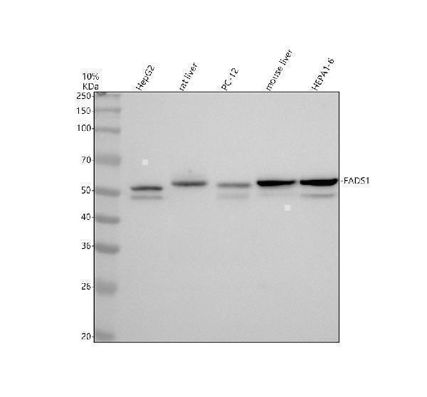 Western blot analysis of FADS1 using anti-FADS1 antibody (M02535)