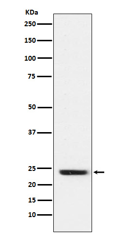 Western blot analysis of FNDC5 expression in Rat muscle cell lysate