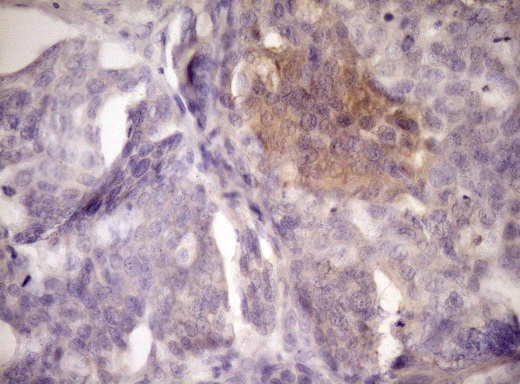 m02539 1 anti loxl2 mouse monoclonal antibody clone id oti8b2 ihc testing 1