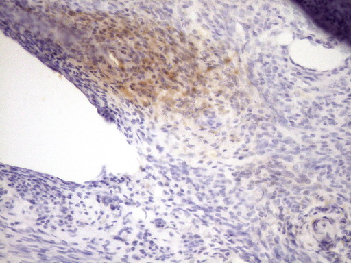 m02539 1 anti loxl2 mouse monoclonal antibody clone id oti8b2 ihc testing 2