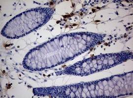 m02541 anti peg3 mouse monoclonal antibody clone id oti1e10 ihc testing 5