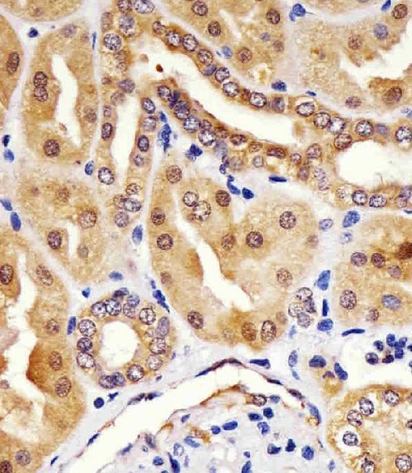 M02557 staining HINT1 in human kidney sections by Immunohistochemistry (IHC-P -paraformaldehyde-fixed, paraffin-embedded sections)