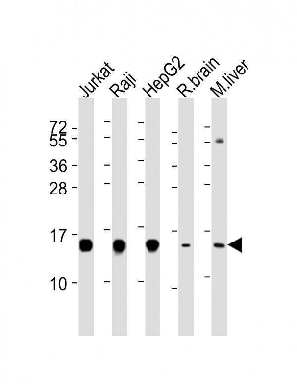All lanes : Anti-HINT1 Antibody at 1:4000 dilutionLane 1: Jurkat whole cell lysatesLane 2: Raji whole cell lysatesLane 3: HepG2 whole cell lysatesLane 4: rat brain lysatesLane 5: mouse liver lysatesLysates/proteins at 20 μg per lane