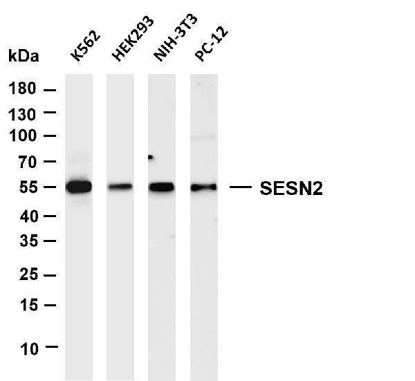m02558 1 sesn2 primary antibodies wb testing 1