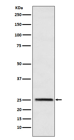 Western blot analysis of Triosephosphate isomerase expression in HeLa cell lysate
