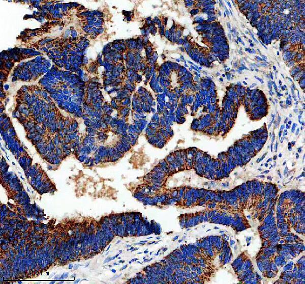 m02561 1 hspa9 primary antibodies ihc testing 1