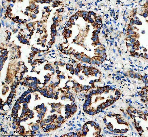 m02561 1 hspa9 primary antibodies ihc testing 2