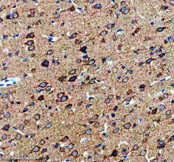 m02561 1 hspa9 primary antibodies ihc testing 3