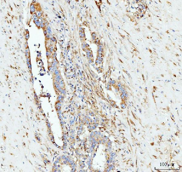  IHC analysis of Grp75 using anti-Grp75 antibody (M02561-2)