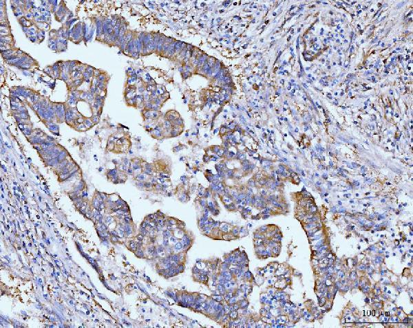  IHC analysis of Grp75 using anti-Grp75 antibody (M02561-2)