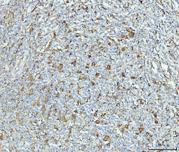 m02561 2 grp75 primary antibodies ihc testing 5