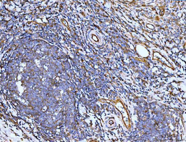 m02562 1 flnb primary antibodies ihc testing 3