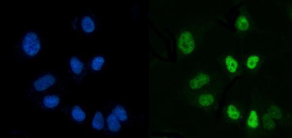 m02567 1 ctbp2 primary antibodies if testing 5