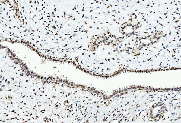  IHC analysis of CTBP2 using anti-CTBP2 antibody (M02567-1)