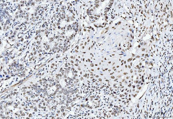  IHC analysis of CTBP2 using anti-CTBP2 antibody (M02567-1)