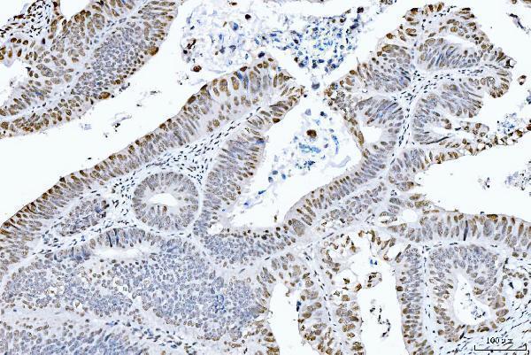 m02567 1 ctbp2 primary antibodies ihc testing 4