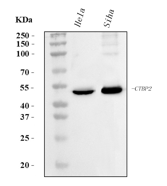  Western blot analysis of CTBP2 using anti-CTBP2 antibody (M02567-1)