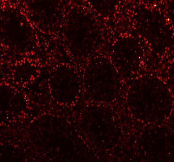 m02567 3 ctbp2 primary antibodies if testing 1