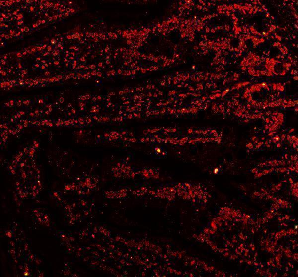m02567 3 ctbp2 primary antibodies if testing 2