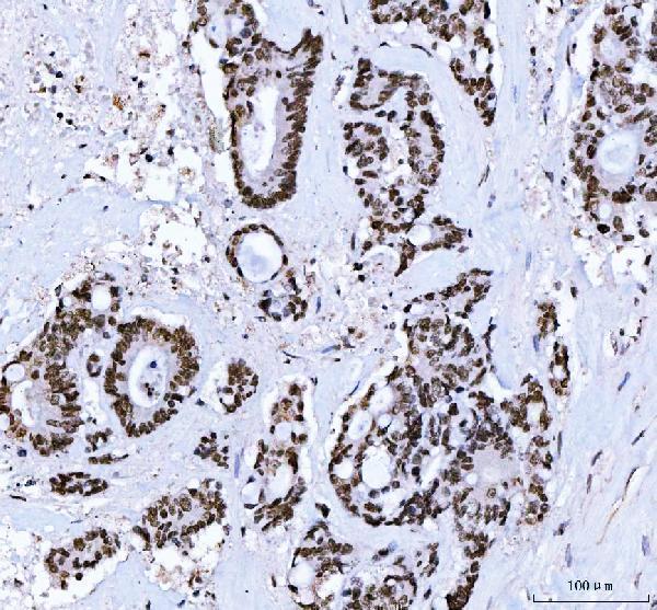 IHC analysis of CTBP2 using anti-CTBP2 antibody (M02567-3)