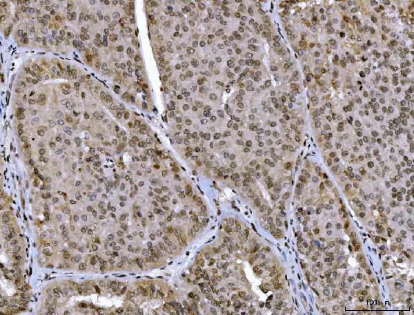  IHC analysis of CTBP2 using anti-CTBP2 antibody (M02567-3)