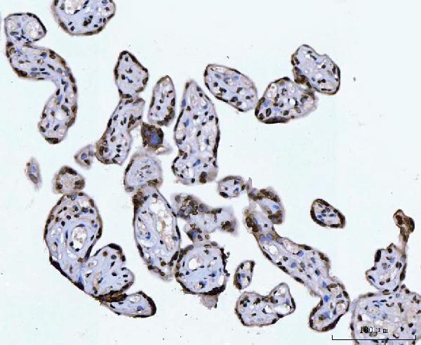 m02567 3 ctbp2 primary antibodies ihc testing 4