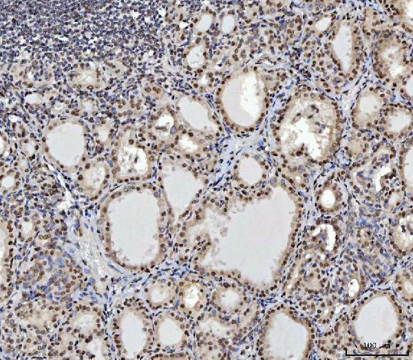 m02567 3 ctbp2 primary antibodies ihc testing 5
