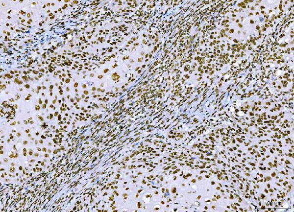 m02567 3 ctbp2 primary antibodies ihc testing 6
