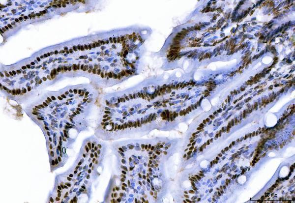 m02567 3 ctbp2 primary antibodies ihc testing 7
