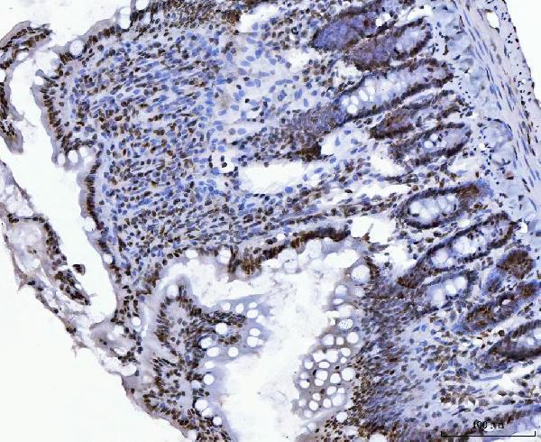 m02567 3 ctbp2 primary antibodies ihc testing 8