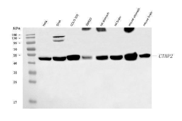 Western blot analysis of CTBP2 using anti-CTBP2 antibody (M02567-3)
