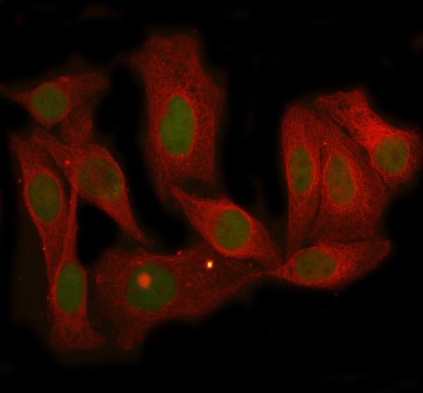  IF analysis of MBD3 using anti-MBD3 antibody (M02571-3) and anti-Beta Tubulin antibody (M01857-3)