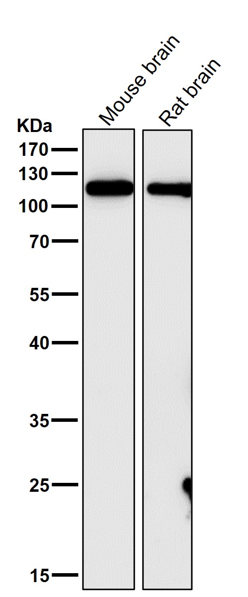 All lanes use the Antibody at 1:1W dilution for 1 hour at room temperature