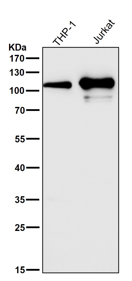 All lanes use the Antibody at 1:1W dilution for 1 hour at room temperature