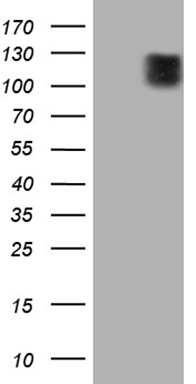 HEK293T cells were transfected with the pCMV6-ENTRY control (Left lane) or pCMV6-ENTRY ARHGEF2 (Right lane) cDNA for 48 hrs and lysed