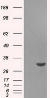 HEK293T cells were transfected with the pCMV6-ENTRY control (Left lane) or pCMV6-ENTRY BIRC7 (Right lane) cDNA for 48 hrs and lysed