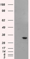 m02577 anti livin birc7 mouse monoclonal antibody clone id oti1d12 wb testing 1