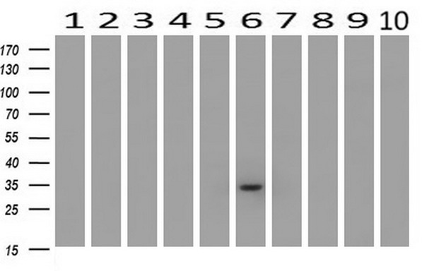 m02577 anti livin birc7 mouse monoclonal antibody clone id oti1d12 wb testing 2