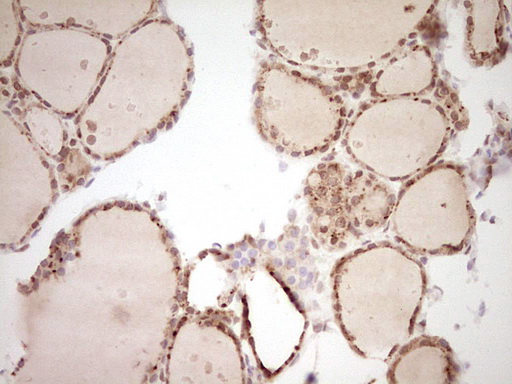 m02578 anti nor1 nr4a3 mouse monoclonal antibody clone id oti5c2 ihc testing 2