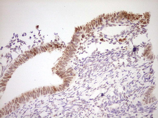 m02578 anti nor1 nr4a3 mouse monoclonal antibody clone id oti5c2 ihc testing 3