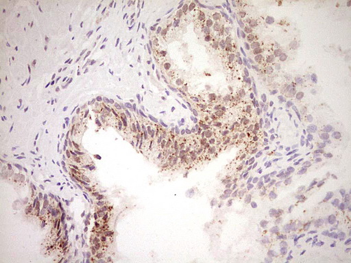 m02578 anti nor1 nr4a3 mouse monoclonal antibody clone id oti5c2 ihc testing 4