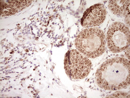m02578 anti nor1 nr4a3 mouse monoclonal antibody clone id oti5c2 ihc testing 5