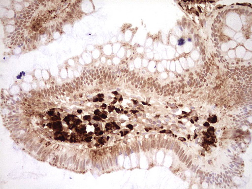 m02578 anti nor1 nr4a3 mouse monoclonal antibody clone id oti5c2 ihc testing 6