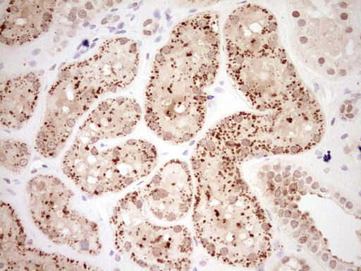 m02578 anti nor1 nr4a3 mouse monoclonal antibody clone id oti5c2 ihc testing 7