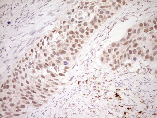 m02578 anti nor1 nr4a3 mouse monoclonal antibody clone id oti5c2 ihc testing 8