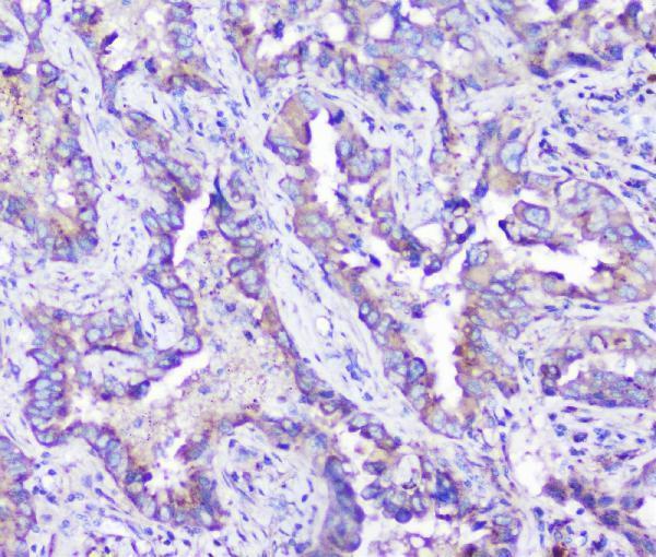m02583 arsa primary antibodies ihc testing 5